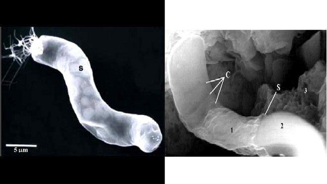 Actual Bacterium vs. alien bacterium